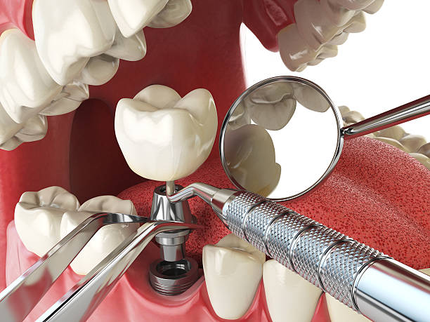 Best Emergency Root Canal Treatment in Fort Defiance, AZ